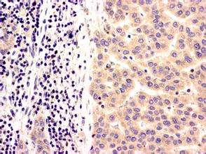 yy易游(中国)体育-米乐官方网站