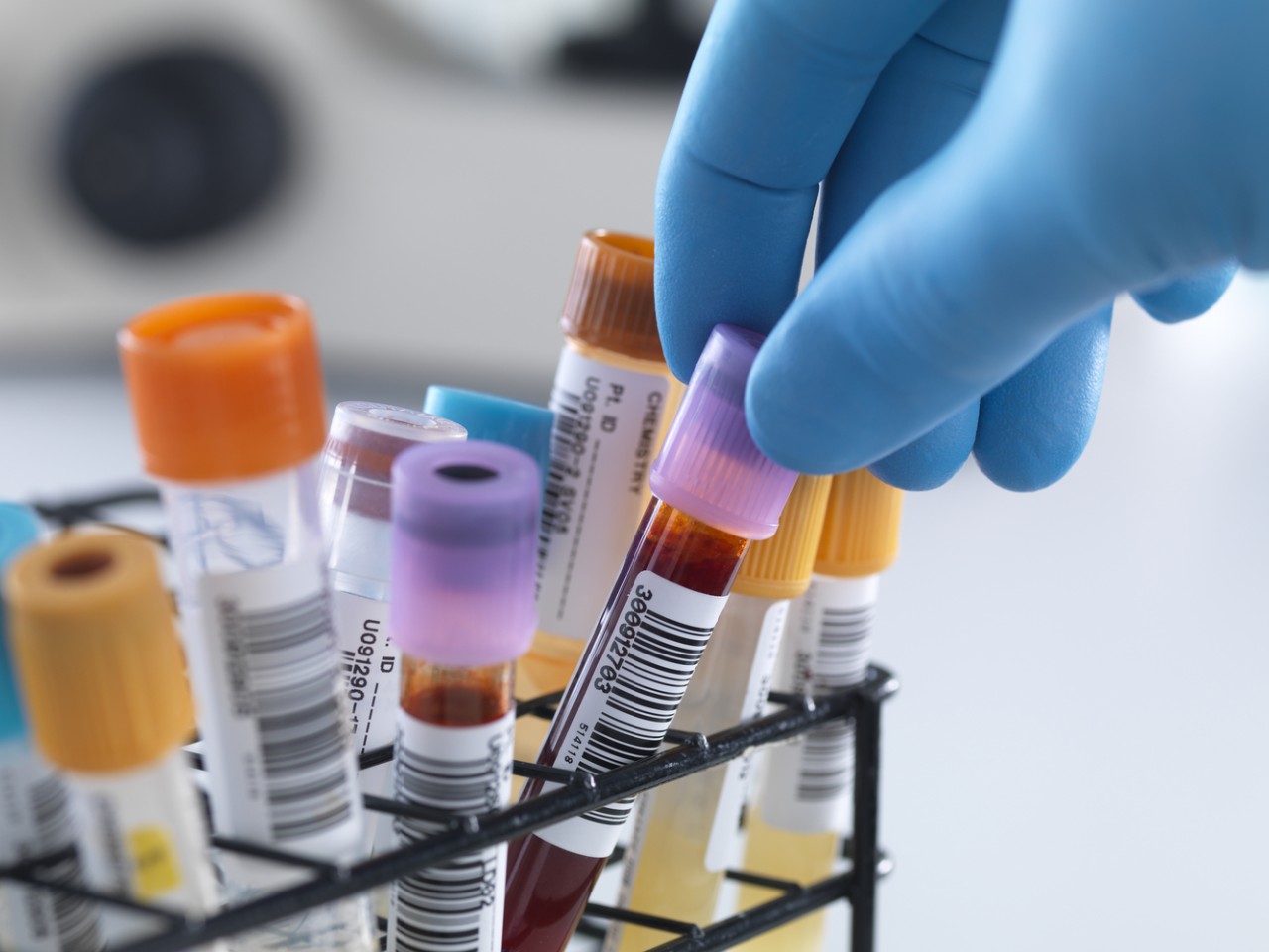 一致性评价大幕开启，，，，，，，，医院市场即将调解