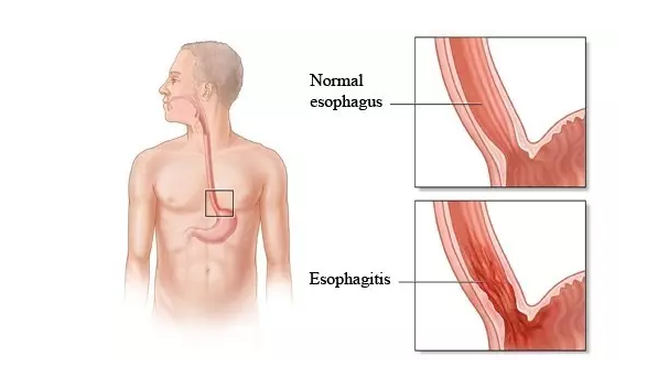 yy易游(中国)体育-米乐官方网站