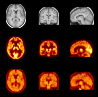 药物在小鼠腹腔的动态漫衍和药物在脑的区域漫衍