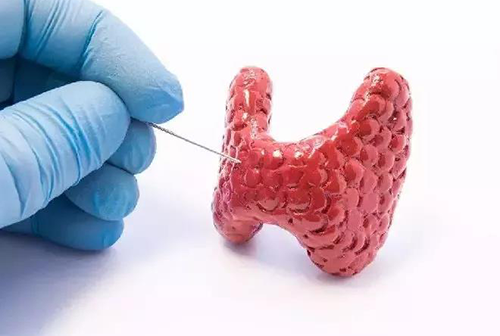 甲状腺疾病，，，，，包括甲状腺功效减退和甲状腺功效亢进，，，，，自古以来就是重复被医学研究职员研究的疾病